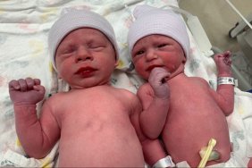 Twins were born in the US from embryos frozen more than 30 years ago