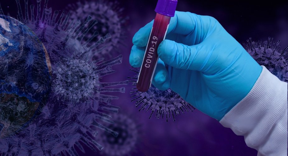 COVID-19: Ukraine has 3.13 million patients during the pandemic, last week 23,283 people were infected