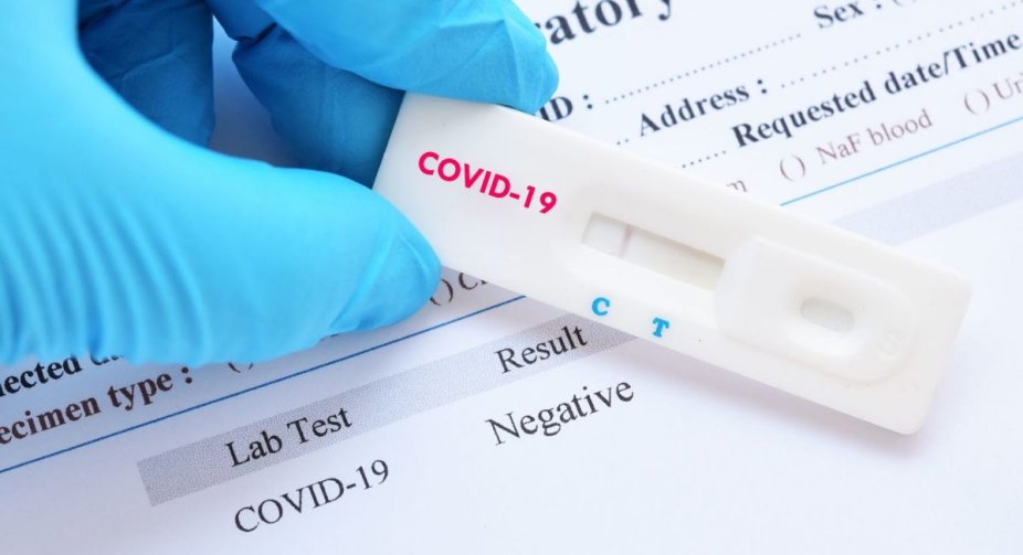 В Україні вже 3,28 млн випадків COVID-19, за добу – 20 591