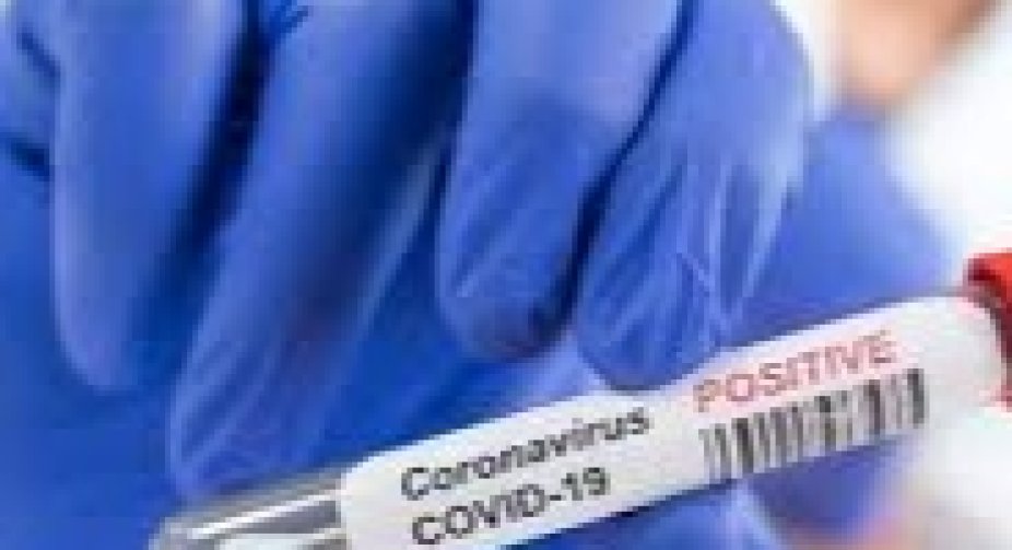 The US is about to top 500,000 Covid-19 deaths. That's why it's critical to keep up safety measures, Fauci says