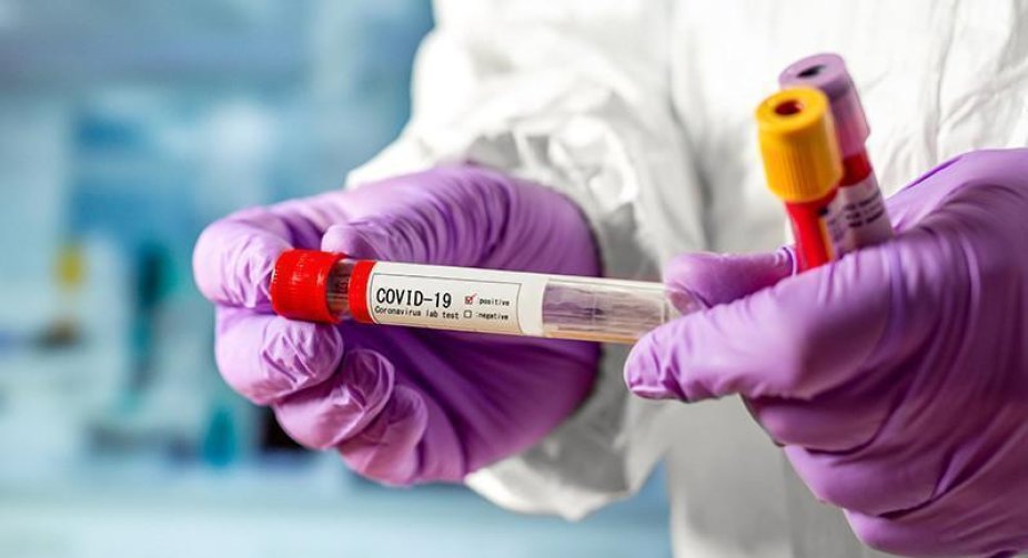 За добу – 23 378 випадків COVID-19. Захворюваність серед дітей зростає