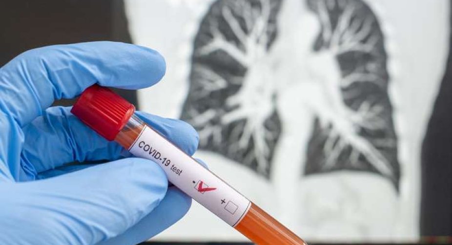 В Україні за добу – 38 257 випадків COVID-19, всього 4,38 млн