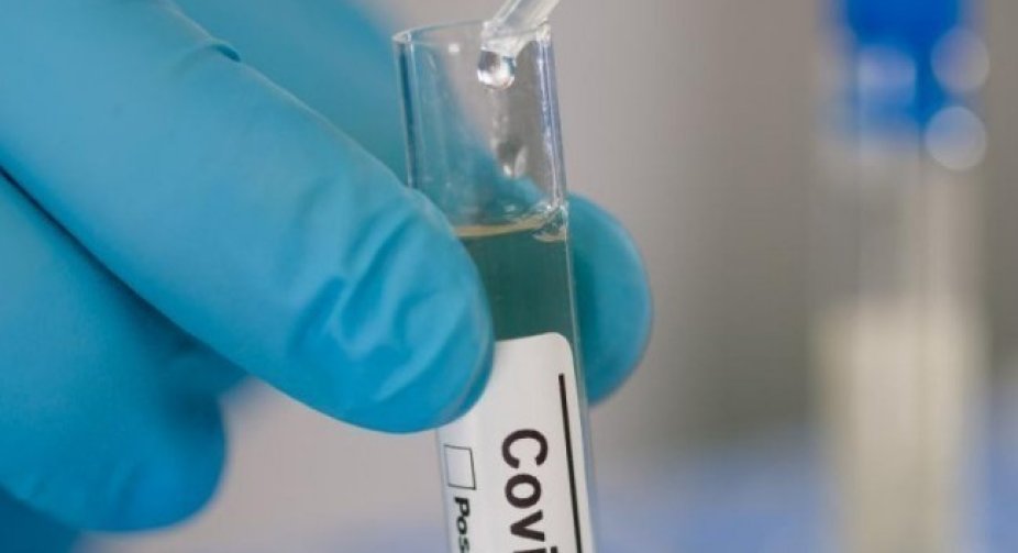 Out of 355 new cases of coronavirus, 176 were detected in Tbilisi