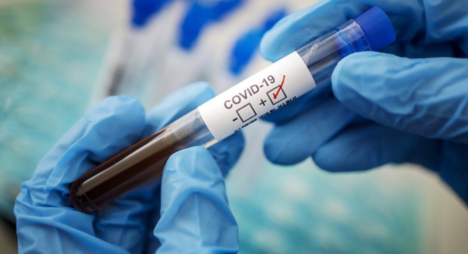 The Ministry of Health spoke about a new strain of Covid-19