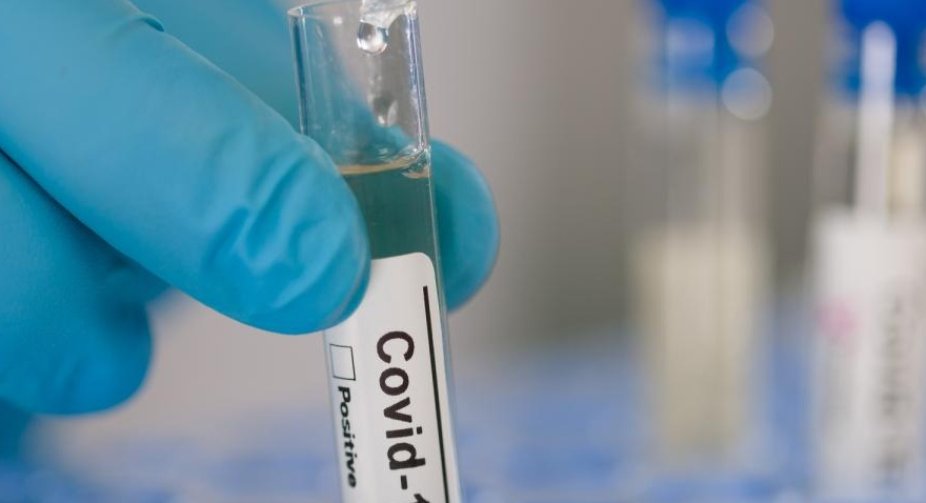 У 70 країнах вже виявили "британський" штам COVID-19