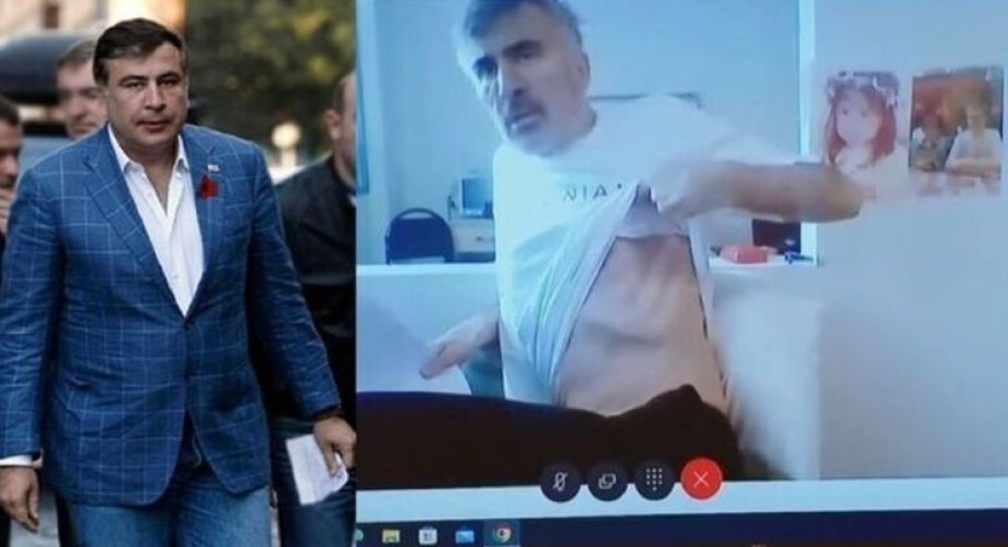The doctor denied information that Saakashvili's weight had dropped to 58 kg.