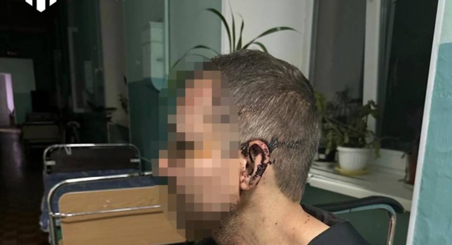 Incident in a military unit: a staff member beat a soldier in Odesa region