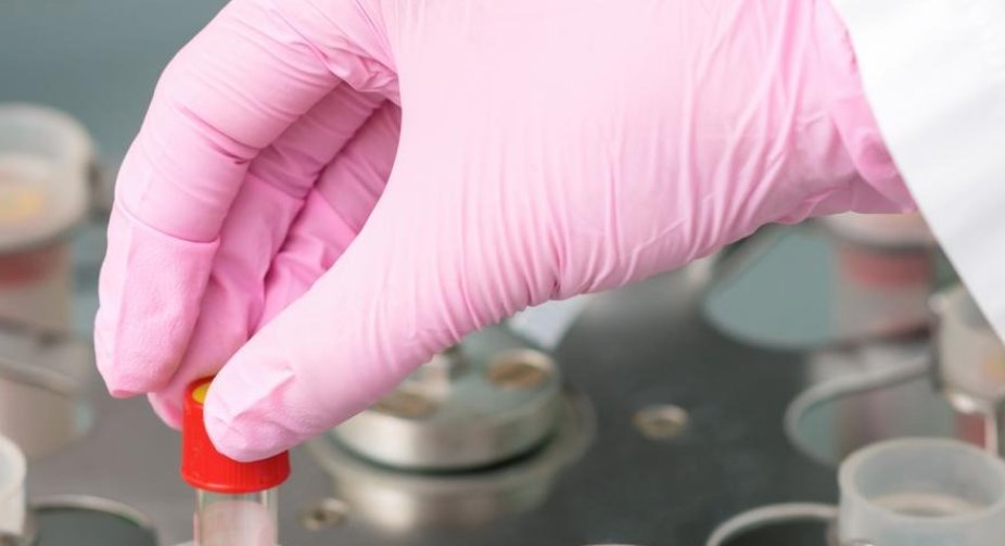 A highly infectious "Brazilian" strain of COVID-19, from which the vaccine may not protect, has been identified in the US - Golubovskaya