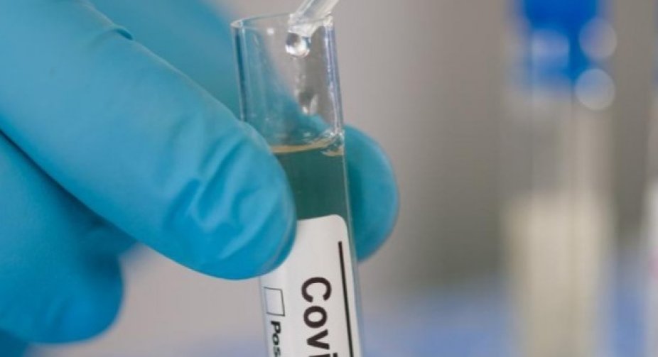 In Ukraine 6,295 new cases of coronavirus were detected today