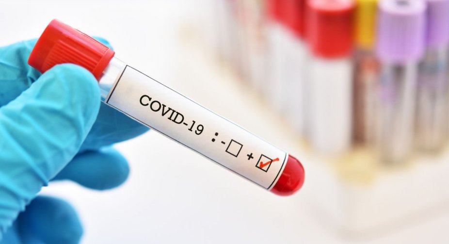 COVID-19: There are already 2.61 million patients in Ukraine, 13,624 people fell ill last night