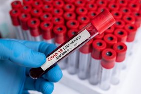 Omicron Symptoms. The Ministry of Health has officially published a list of symptoms
