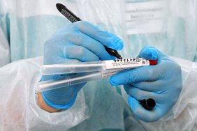 In Ukraine, there were 10,476 cases per day. COVID-19 incidence is increasing