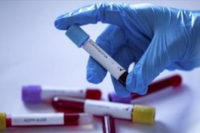 В Україні за добу – 24 440 випадків COVID-19