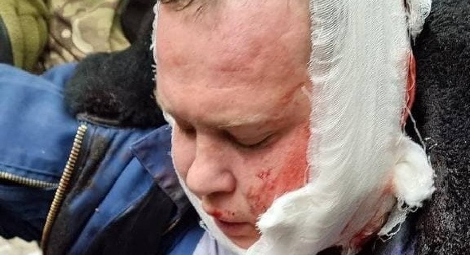Українські військові збили ворожий штурмовик під Черніговом, пілота затримали