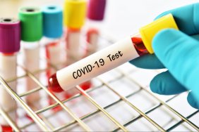 More than 10 thousand in a week: the incidence of covid in Ukraine jumped by another quarter