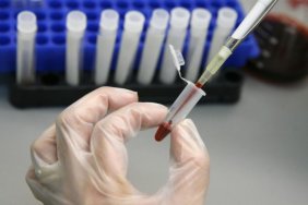 Hepatitis A outbreak detected in Vinnytsia region: 60 people hospitalized