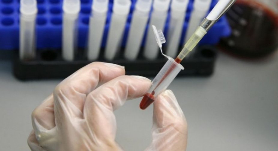 Hepatitis A outbreak detected in Vinnytsia region: 60 people hospitalized