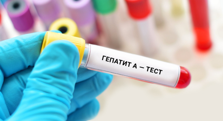 In addition to Vinnytsia, cases of viral hepatitis A have been detected in five more communities - RMA
