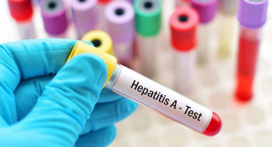 Hepatitis A detected in Ternopil region: latest news