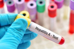 Hepatitis A detected in Ternopil region: latest news