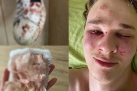 У Закарпатському ТЦК прокоментували спробу суїциду: Його ніхто не бив, він був неадекватний, імовірно, вживав наркотичні речовини