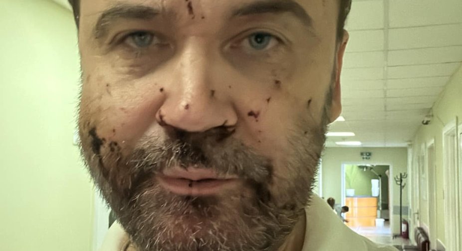 Пономарьов стверджує, що БПЛА атакував його будинок цілеспрямовано, а ППО по дрону навіть не працювала