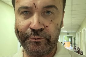 Пономарьов стверджує, що БПЛА атакував його будинок цілеспрямовано, а ППО по дрону навіть не працювала